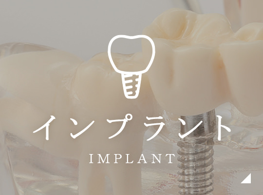インプラント Implant
